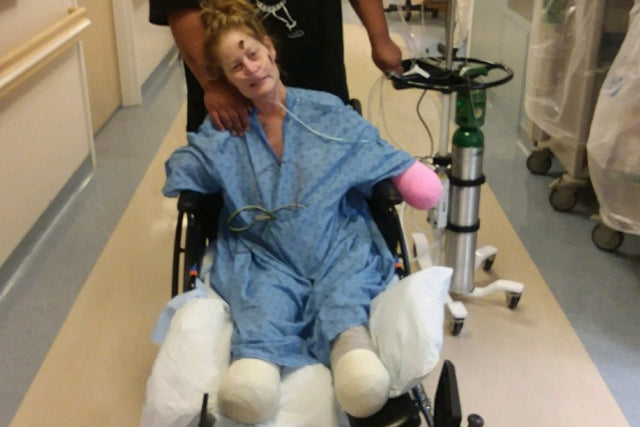 PhoneSoap Cares | How a cold turned into a quadruple amputation for a mother of 6