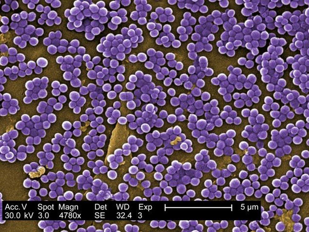 MRSA and S. aureus