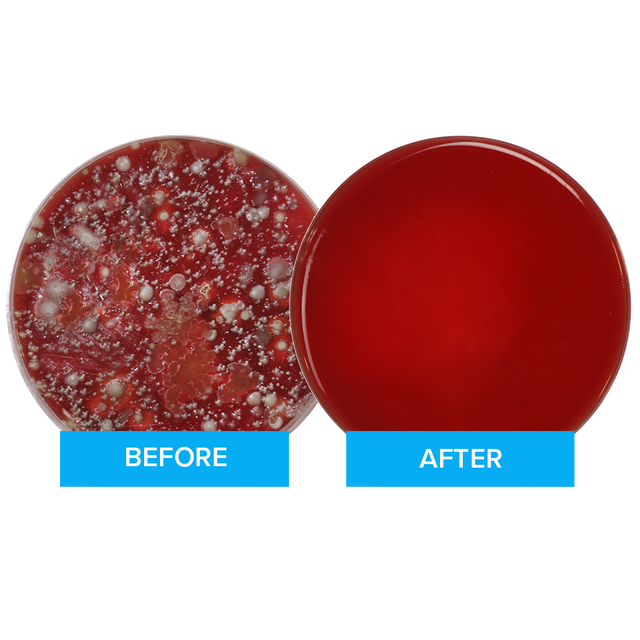 What Bacteria is on my Phone?
