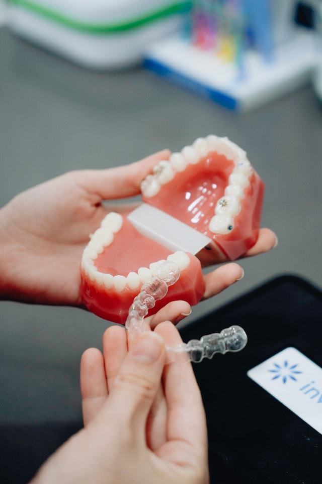How To Sanitize Retainer